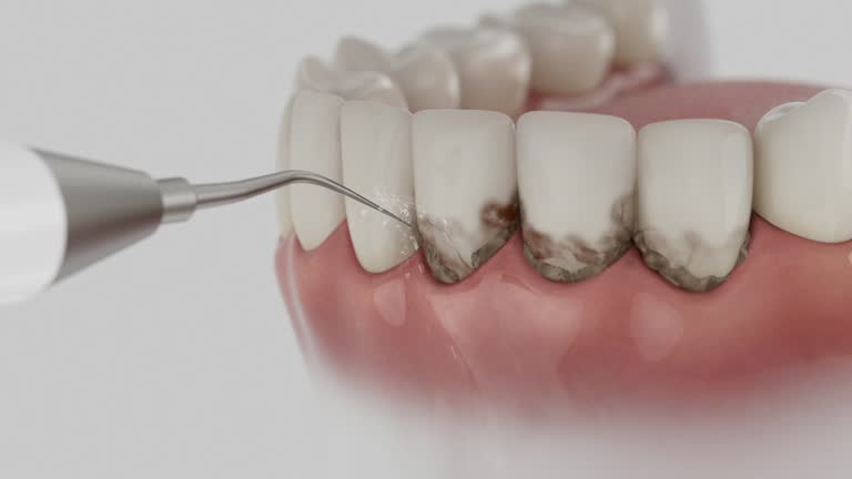 Reliable Dental Implants contractor in Roosevelt, NY by Smile Center Dentistry